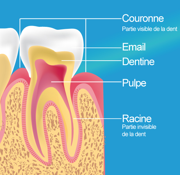 Dévitalisation - Traitement Endodontique
